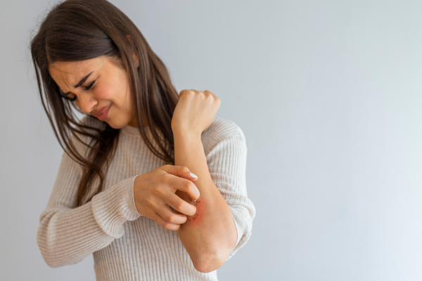 Best Eczema Treatment in Pimpri Chinchwad, Pune by Dr. Gauri